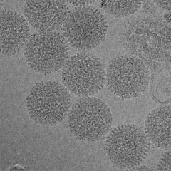 Unstained Rift Valley fever virus (RVFV) particles