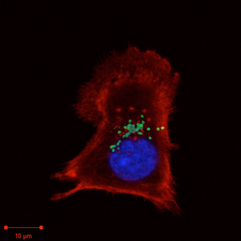 Orientia tsutsugamushi bacteria (green) inside a mouse fibroblast cell (red) 50 minutes after infection.